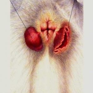 Outer Rectum Pain - Hemorrhoids Image - Outside Hemorrhoid Surgery - Hemmorrhoid Cure