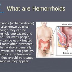 Homecure For Hemm - Get Rid Of Hemorrhoids Fast And Painlessly - Identify Your Hemorrhoids